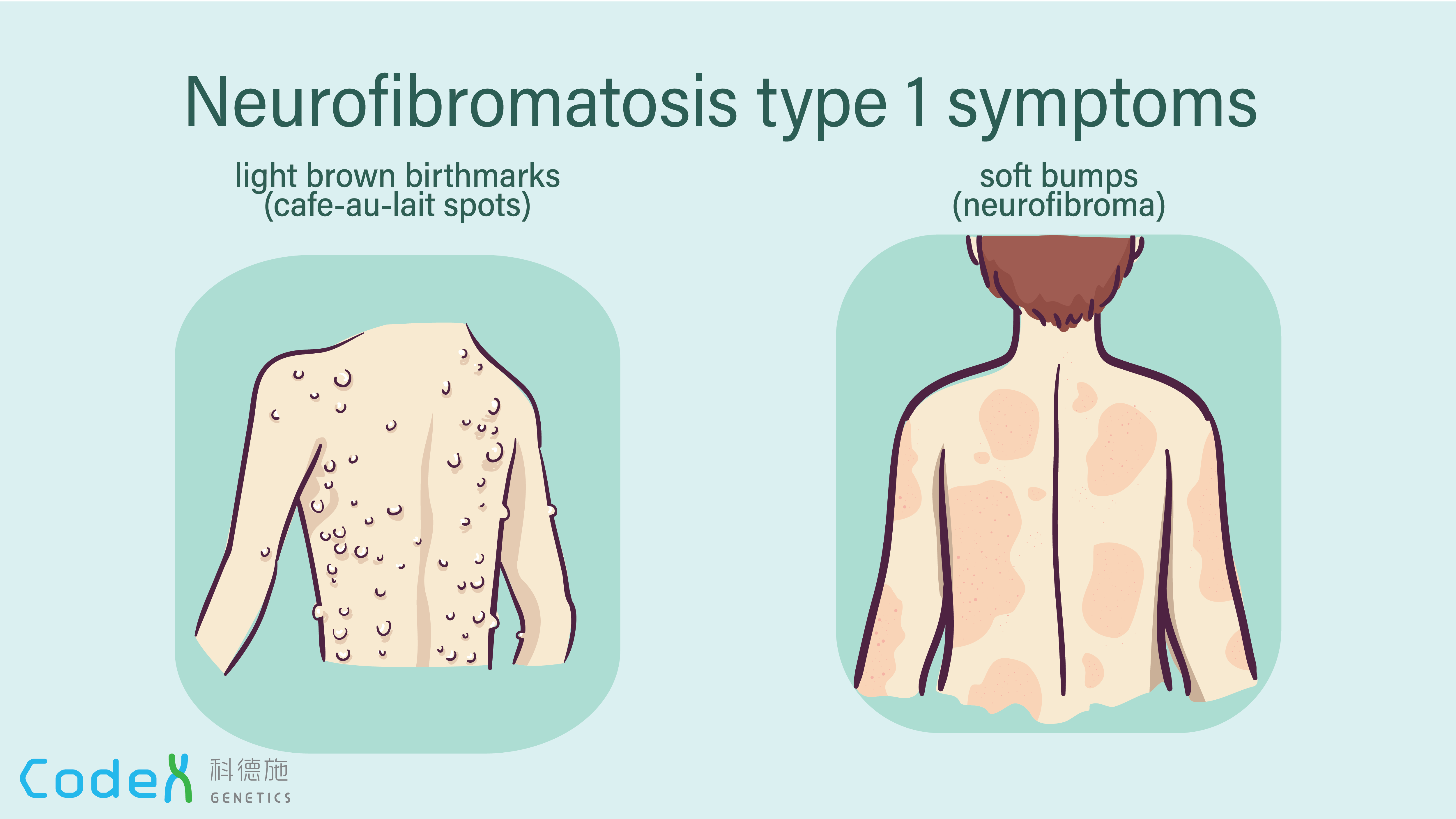 Neurofibromatosis